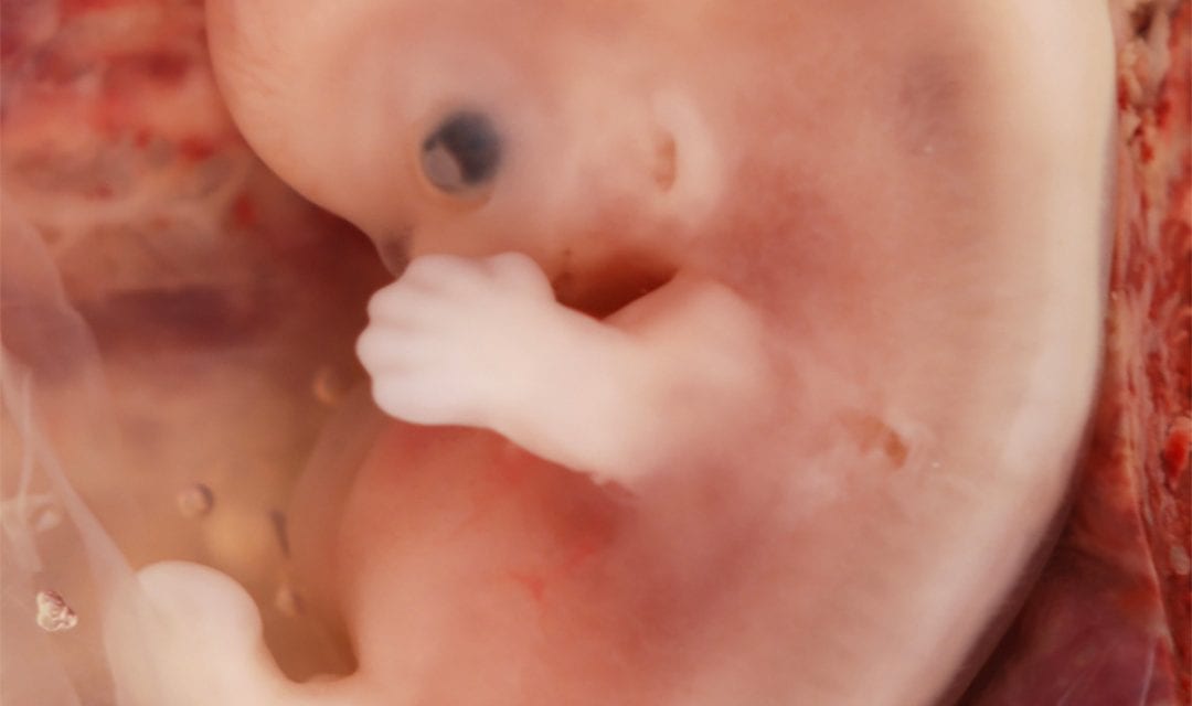 Controversial fetal heartbeat bill shelved until next legislative year