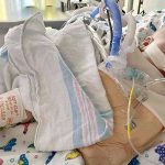 Spike in RSV cases seen at children’s hospitals across South Carolina